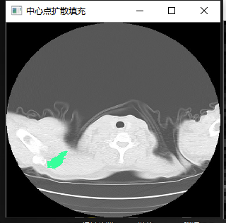 C#处理医学影像(四):基于Stitcher算法拼接人体全景脊柱骨骼影像