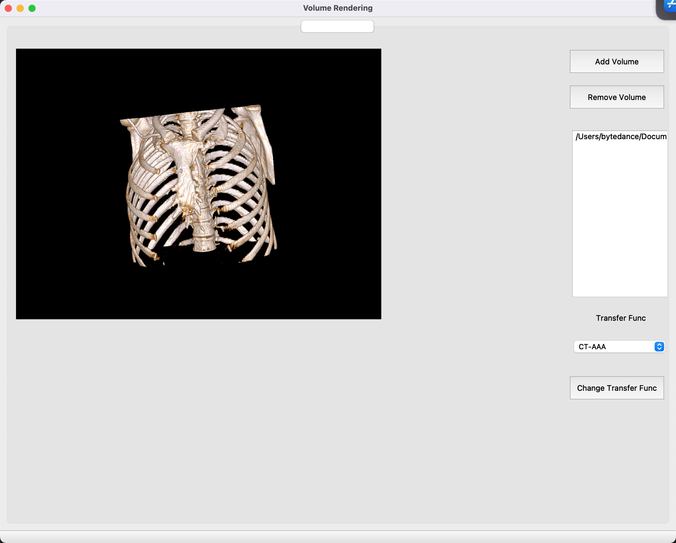 [Medical Image] 利用VTK和PyQt5对医学体数据进行渲染并展示