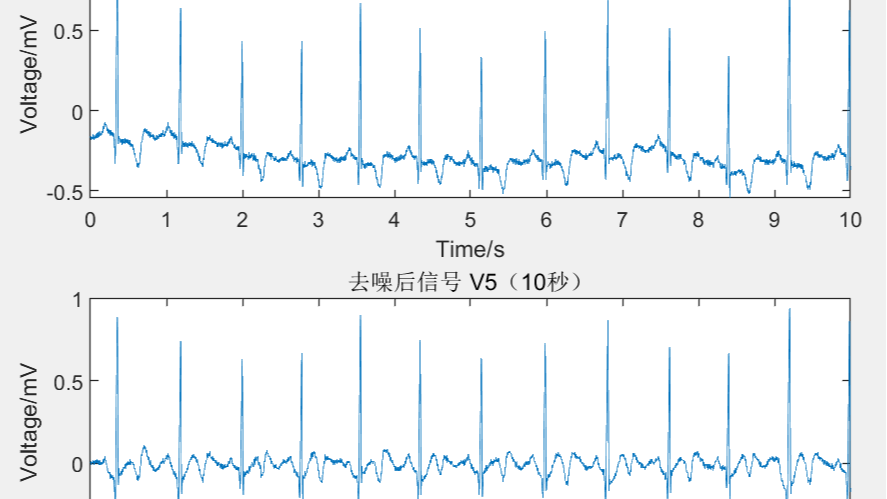 心电信号小波去噪