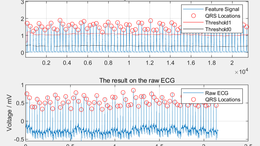 心电信号QRS检测算法1