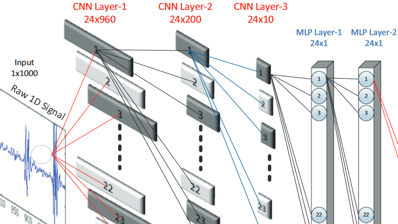 笔记：1D convolutional neural networks and applications: A survey